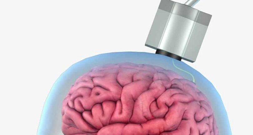 Wireless ‘thought into action’ brain sensor begins benchtop testing