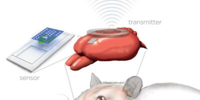 Implantantable sensors monitor brain injury before melting away
