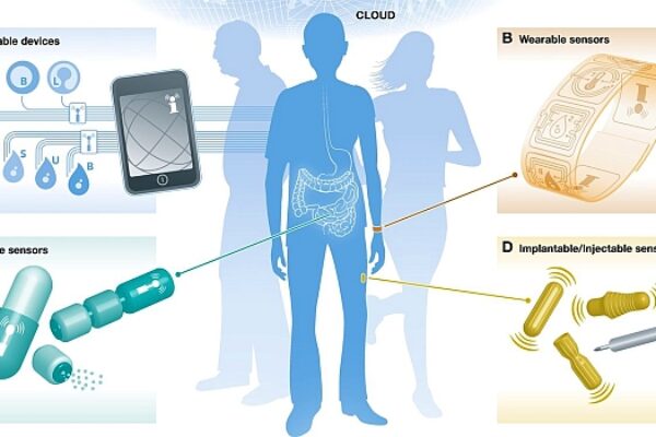 Connected disposable medical sensors to grow at 30% CAGR to 2022