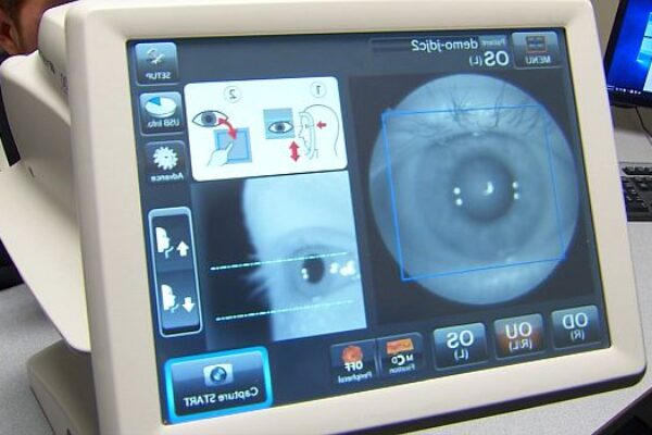 AI device that detects diabetes-related eye disease gains FDA approval
