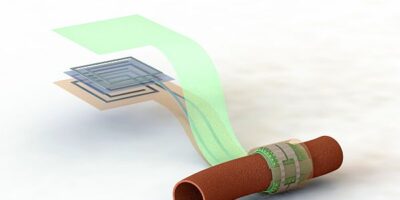Wireless, biodegradable artery sensor monitors healing blood vessels