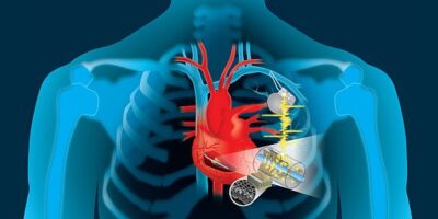 Harvesting the heart’s energy to power implantables