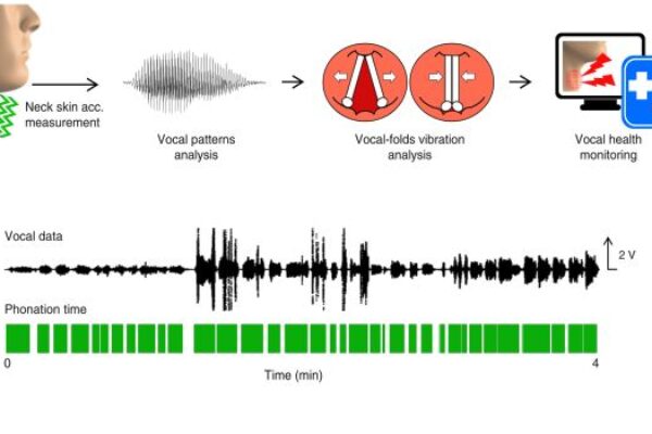 Wearable skin sensor detects vibration for voice recognition