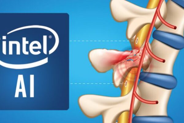 Intel pushes AI to bridge spinal gap in paralyzed patients