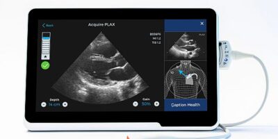 FDA authorizes AI-guided cardiac ultrasound software
