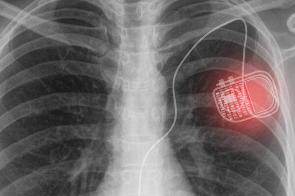 Photonic wireless system to power medical implants