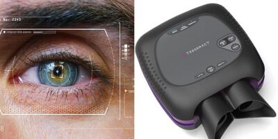 AI eye-imaging diagnostic platform gets funding