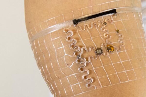 Wireless power drives 3D printed medical wearable